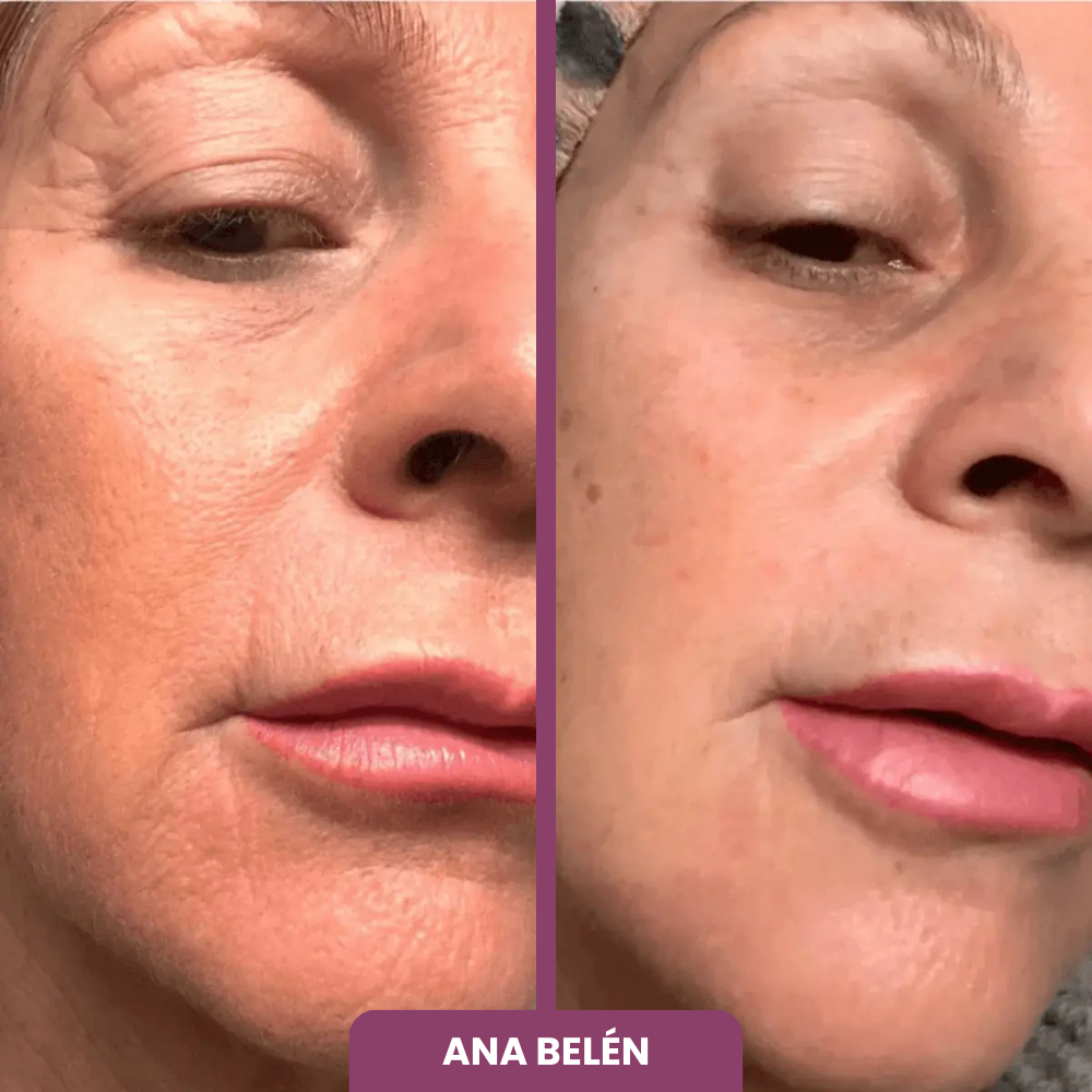 2x1 BÁLSAMO + 10 MASCARILLAS GRATIS