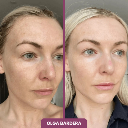 2x1 BÁLSAMO + 10 MASCARILLAS GRATIS