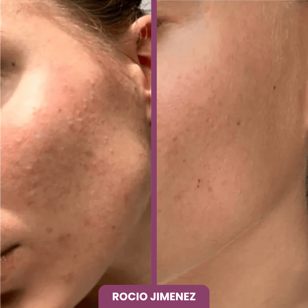 2x1 BÁLSAMO + 10 MASCARILLAS GRATIS